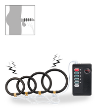 Load image into Gallery viewer, Estim cock ring kit